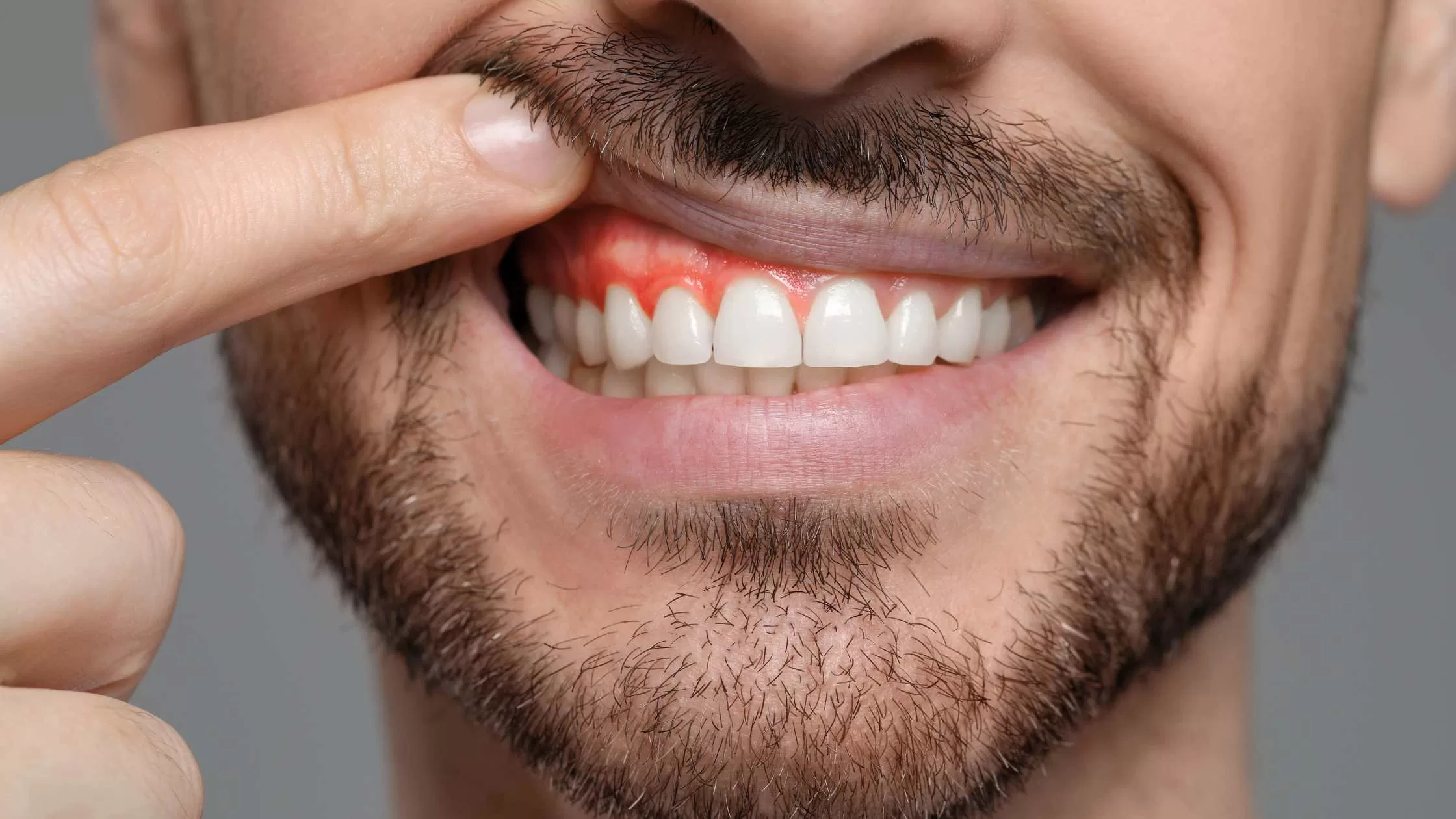 ¿Qué pasa si no trato la periodontitis? ¿La periodontitis se puede curar? Todo lo que debes saber